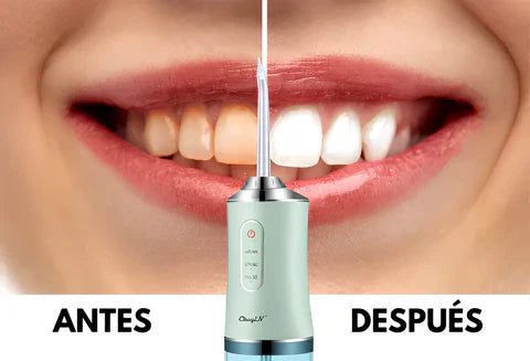 IRRIGADOR DENTAL ANTI CARIES Y QUITA MANCHAS DENTALES +ENVIO GRATIS