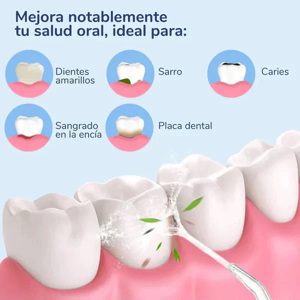 IRRIGADOR DENTAL ANTI CARIES Y QUITA MANCHAS DENTALES +ENVIO GRATIS