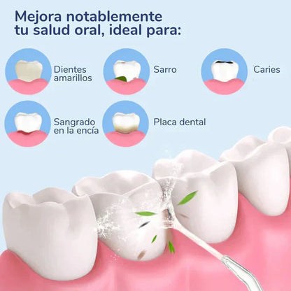 IRRIGADOR DENTAL ANTI CARIES Y QUITA MANCHAS DENTALES +ENVIO GRATIS