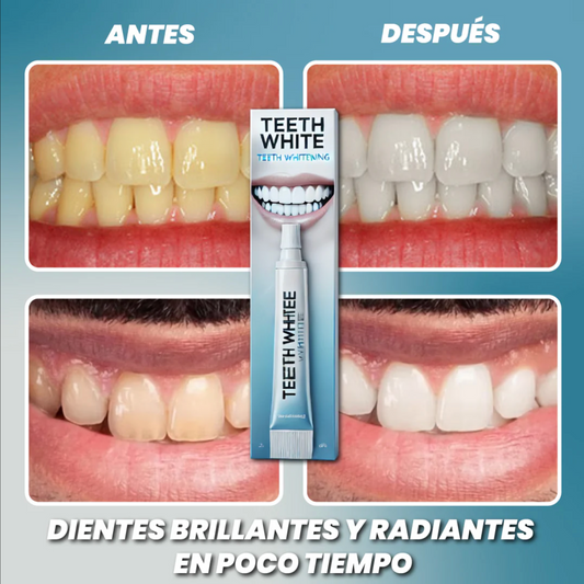 IRRIGADOR DENTAL ANTI CARIES Y QUITA MANCHAS DENTALES +ENVIO GRATIS